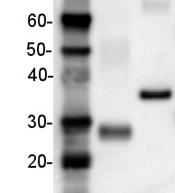 His-tag | 6xHis  (clone HIS,H8 / EH158) in the group Tag Antibodies / His (3x, 6x) at Agrisera AB (Antibodies for research) (AS11 1771)